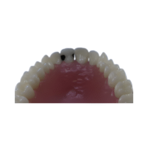 dente-diferenciado-11.1-pronew-300×200