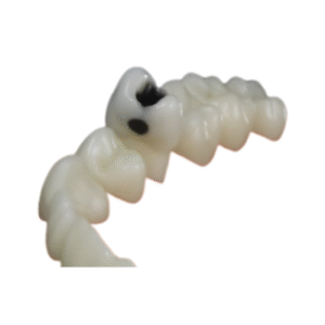 dente-diferenciado-25.2-classe-l-300×200