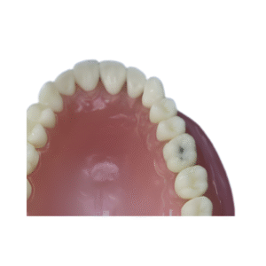 dente-diferenciado-26.6-pronew-300×200