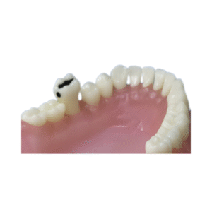 dente-diferenciado-36.2-pronew-300×200