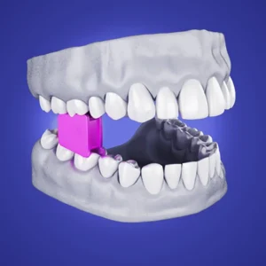 Abridor de Boca Silicone Kit