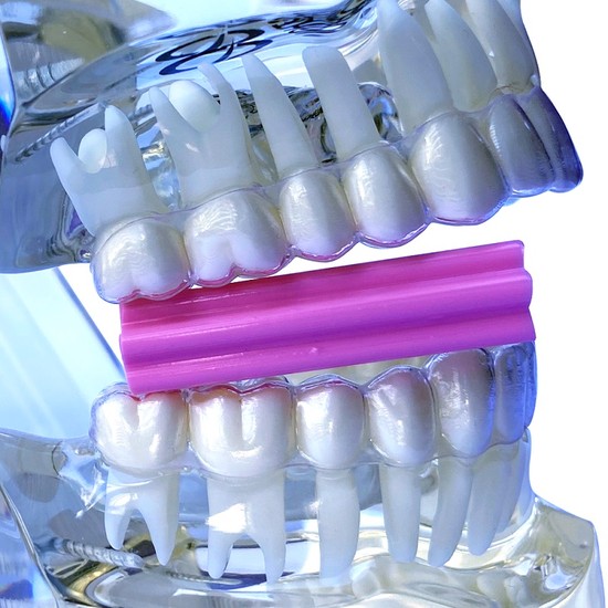 Mordedor para Alinhadores OrthoChewie c/ 3 - Orthometric